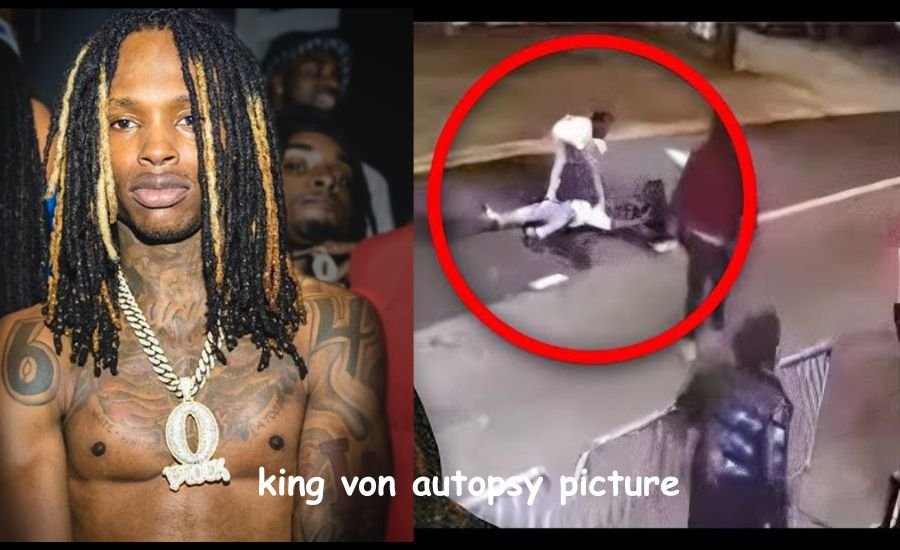 king von autopsy picture